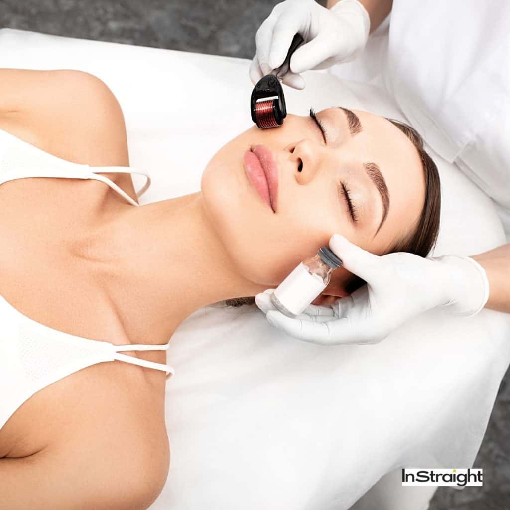 pretty woman getting a dermarolling treatment